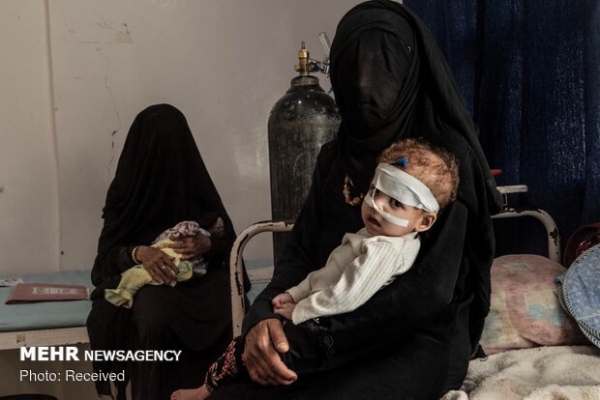 ۲-میلیون-کودک-یمنی-بین-مرگ-و-زندگی-به-سر-می‌برند