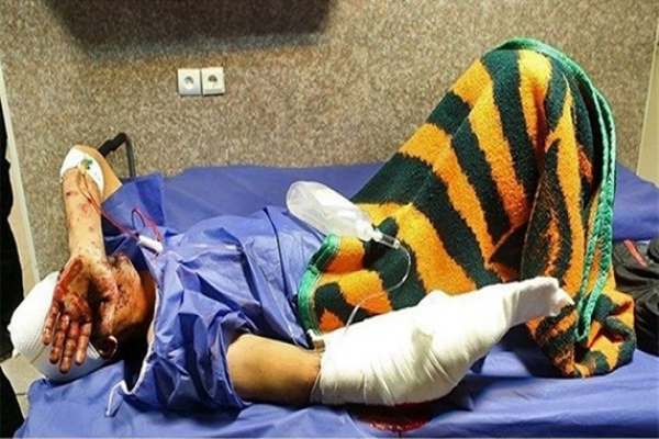 احتمال-تخلیه-چشم-2-زنجانی-بر-اثر-بیاحتیاطی-در-چهارشنبه-سوری-۴۷-نفر-مصدوم-راهی-بیمارستان-شدند