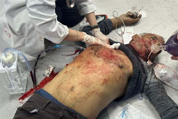 شهادت-500-فلسطینی-در-حمله-صهیونیست‌ها-به-بیمارستان-غزه